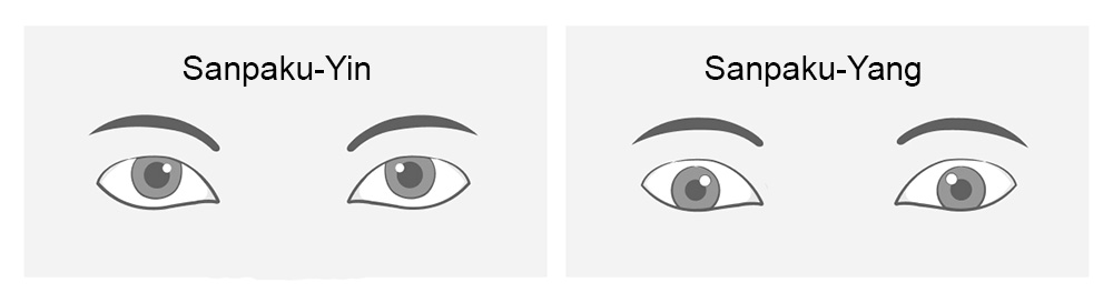 Sanpaku-Augen