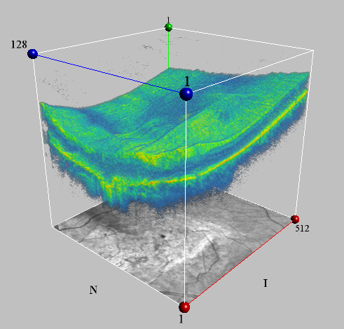 Netzhautschichten im OCT in 3D