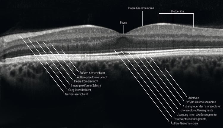 Netzhautschichten im OCT
